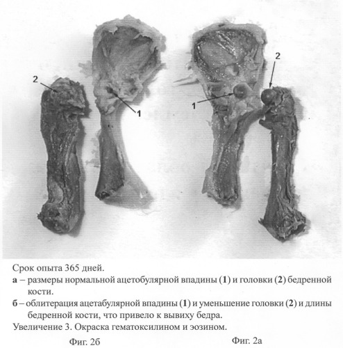 Способ моделирования аномалии бедренной и тазовой костей (патент 2279144)