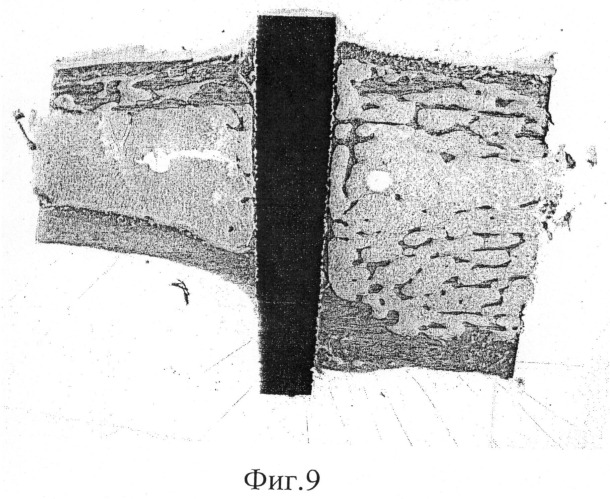 Корпус имплантата, способ его изготовления и зубной имплантат (патент 2471451)