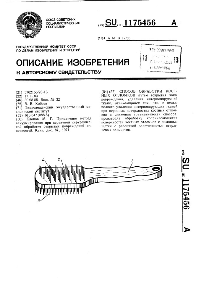 Способ обработки костных отломков (патент 1175456)