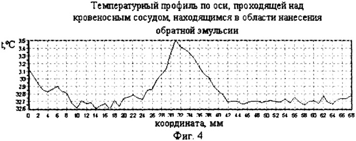 Косметическое средство накожного применения (патент 2304960)