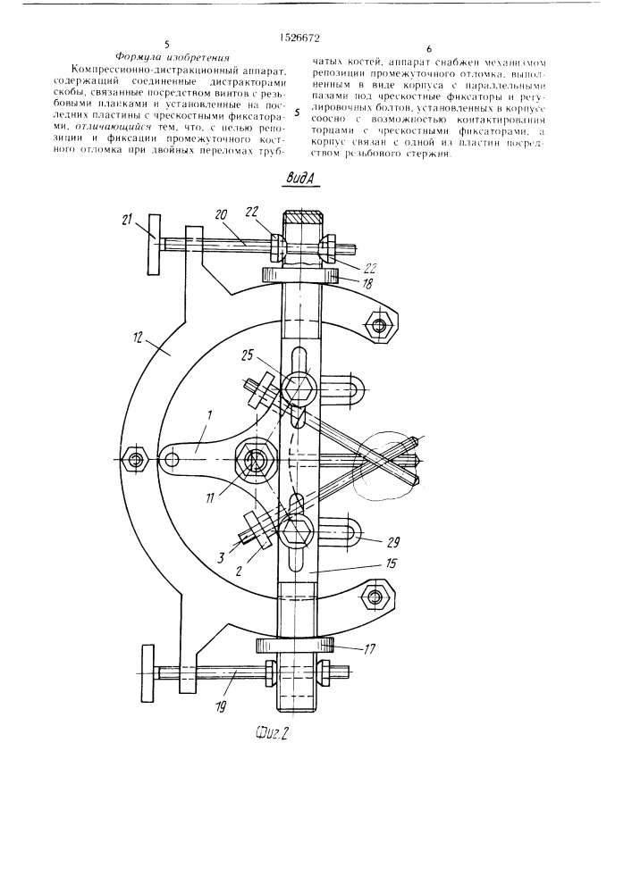 Компрессионно-дистракционный аппарат (патент 1526672)