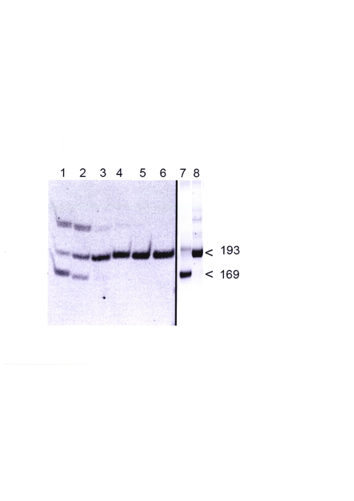 Способ дифференциации токсигенных и атоксигенных штаммов холерных вибрионов 01 серогруппы по ингибирующей активности (патент 2596401)