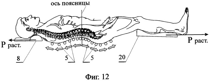 Устройство для коррекции и лечения позвоночника (варианты) (патент 2282431)