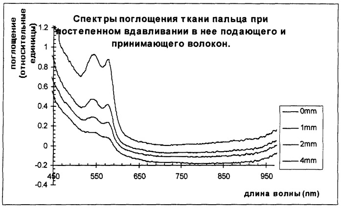 Способ проведения фотодинамической терапии злокачественных опухолей (патент 2275945)