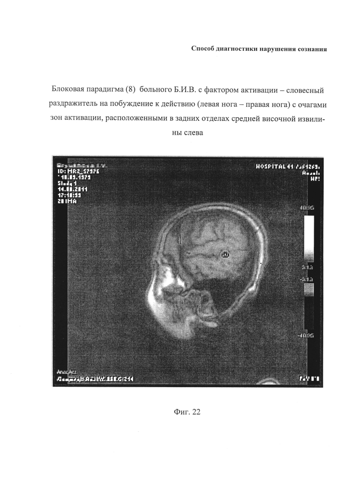 Способ диагностики нарушения сознания (патент 2596049)