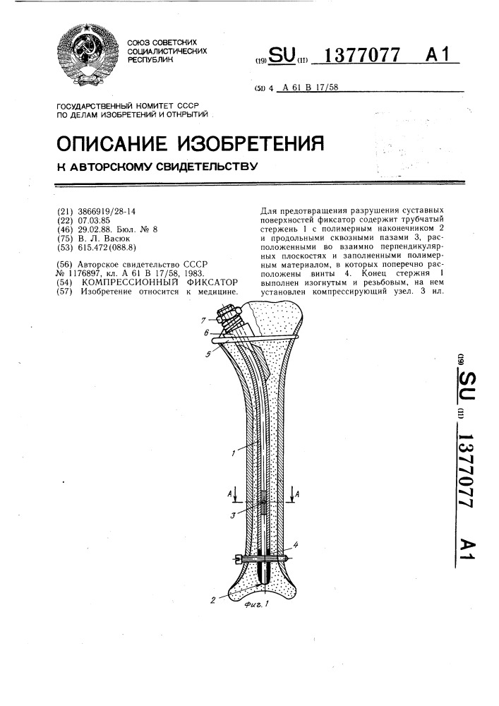 Компрессионный фиксатор (патент 1377077)