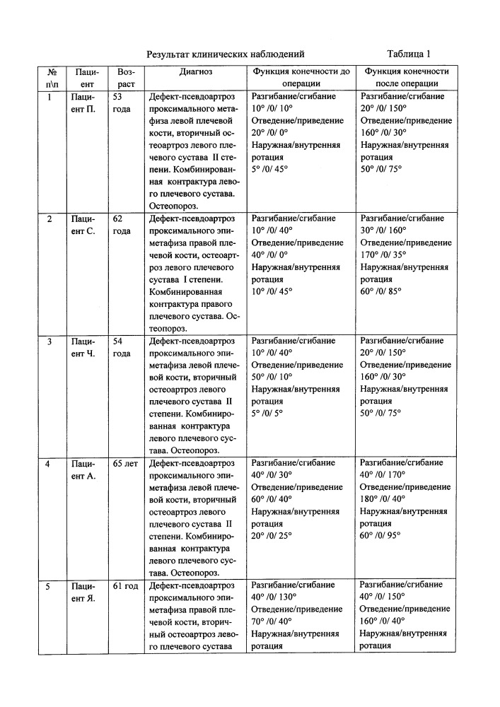 Способ хирургического лечения перелома проксимального отдела плечевой кости (патент 2652573)