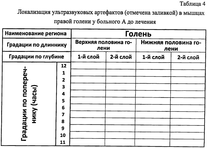 Способ диагностики клинически актуальных мышечно-сухожильных меридианов (патент 2477977)