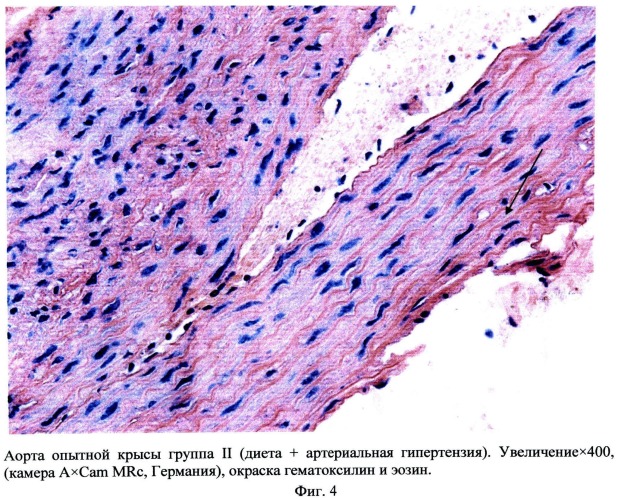 Способ моделирования атеросклероза (патент 2500041)