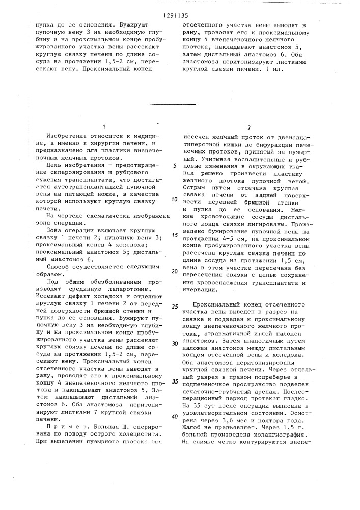 Способ пластики внепеченочных желчных протоков (патент 1291135)