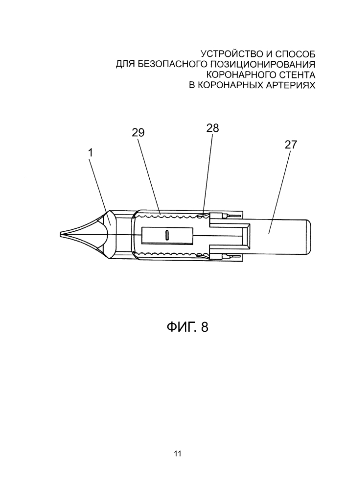Устройство и способ для безопасного позиционирования коронарного стента в коронарных артериях (патент 2598798)