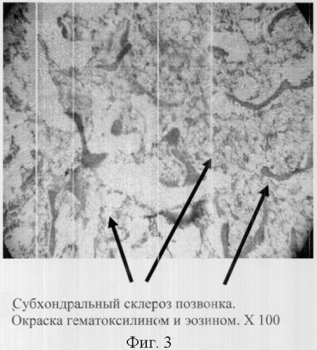 Способ моделирования остеохондроза в эксперименте (патент 2301458)