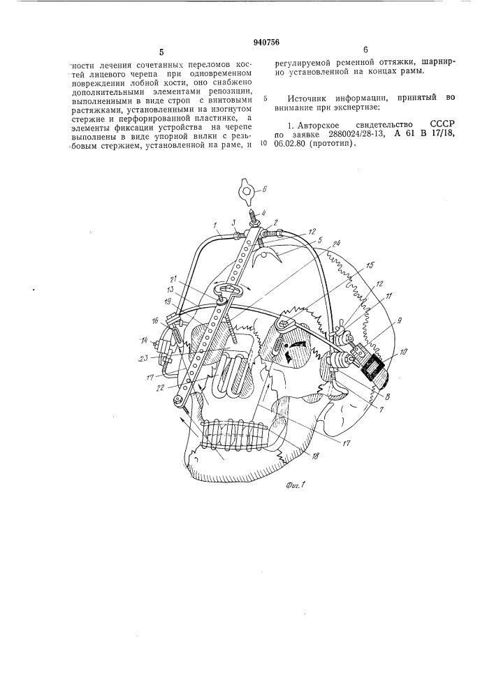 Устройство для лечения переломов костей лицевого черепа (патент 940756)