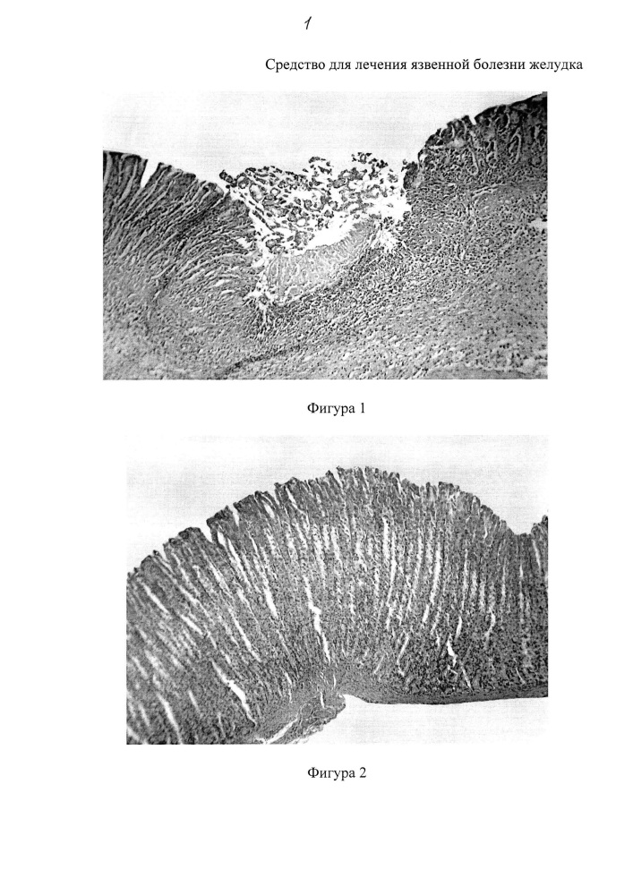 Средство для лечения язвенной болезни желудка (патент 2651771)