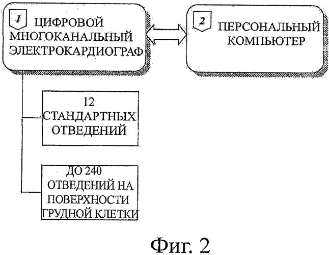 Способ неинвазивного электрофизиологического исследования сердца (патент 2417051)