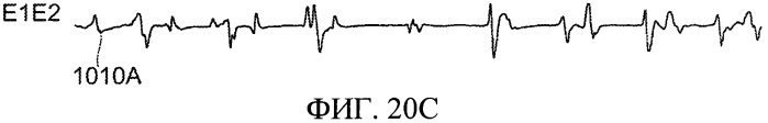 Способы, система и устройство для обнаружения, диагностики и лечения нарушений биологического ритма (патент 2559639)