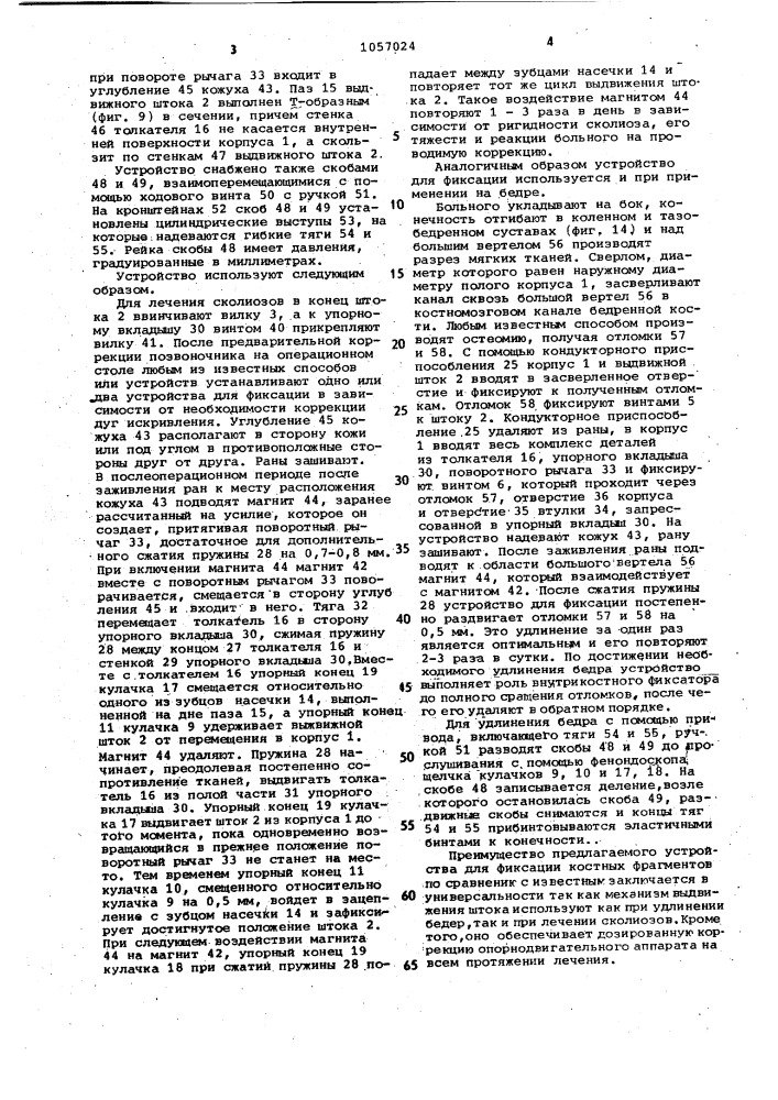 Устройство для фиксации костных фрагментов (патент 1057024)