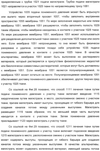 Устройство для лечения путем подкожной подачи пониженного давления с использованием разделения с помощью воздушного баллона (патент 2401652)