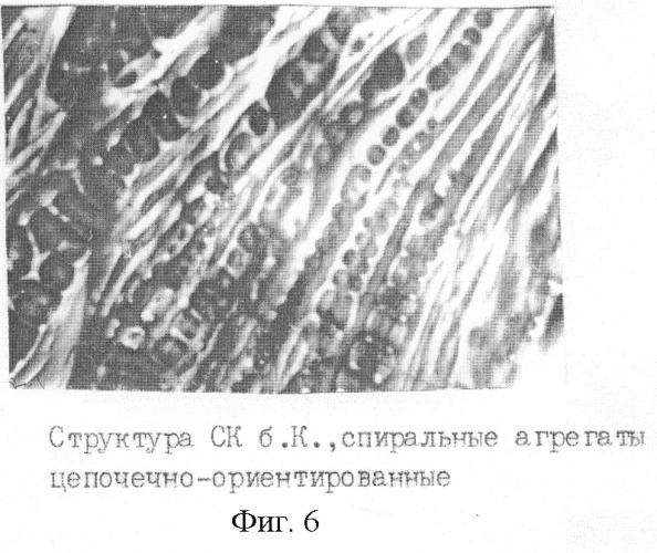 Способ экспресс-диагностики гипер-бета 2-микроглобулинемии (патент 2259565)