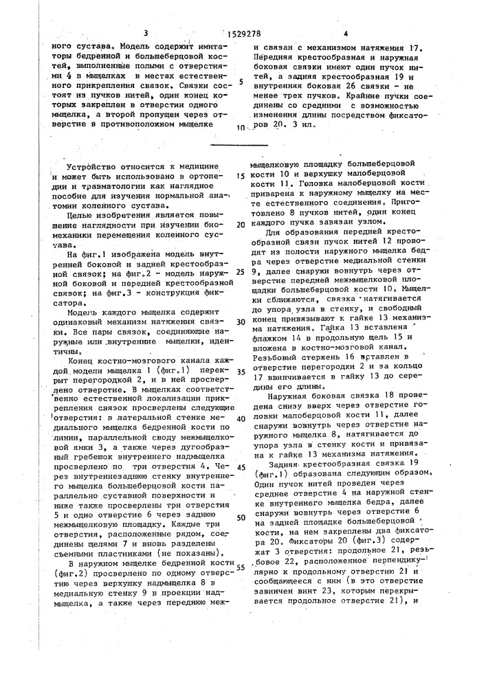 Костно-связочная модель коленного сустава человека (патент 1529278)