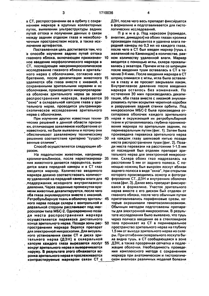 Способ изучения задних путей оттока глазного яблока (патент 1710036)