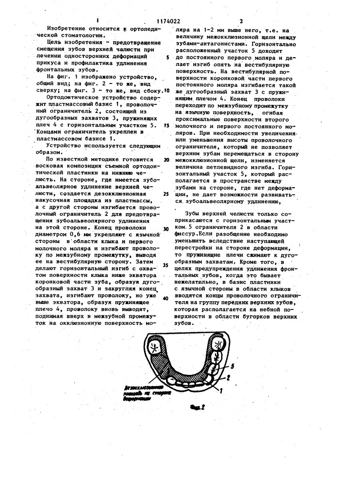 Ортодонтическое устройство (патент 1174022)