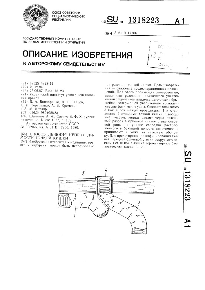 Способ лечения непроходимости тонкой кишки (патент 1318223)