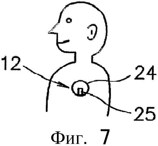 Система контроля биологической информации (патент 2336808)