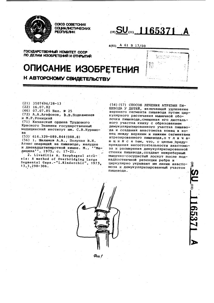 Способ лечения атрезии пищевода у детей (патент 1165371)