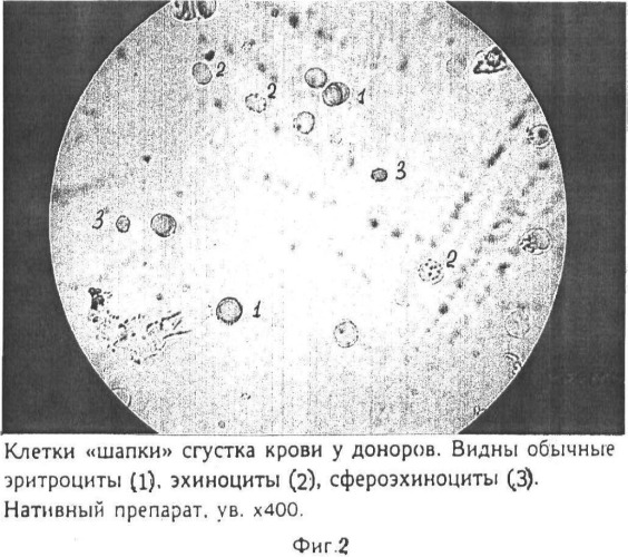 Способ определения тяжести состояния больного и возможной причины патологического процесса (патент 2480754)