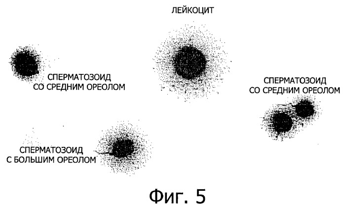 Почему большая ареола. Фрагментация ДНК сперматозоидов. Сперматозоиды животных. Метод оценки сперматозоидов ДНК фрагментация. Фрагментация ДНК сперматозоидов расшифровка.