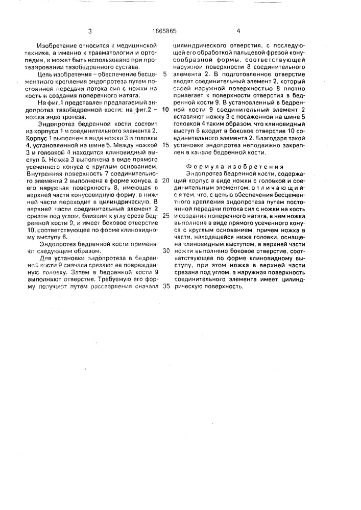 Эндопротез бедренной кости (патент 1665865)