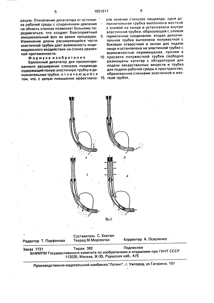 Баллонный дилататор для пролонгированного расширения стенозов пищевода (патент 1651917)