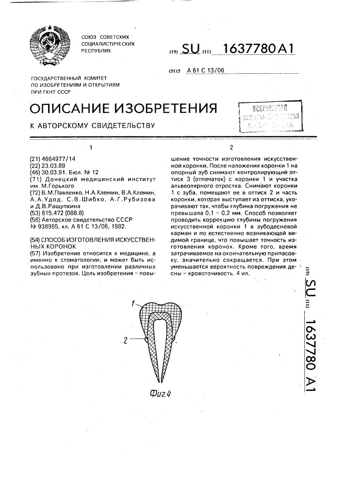 Способ изготовления искусственных коронок (патент 1637780)