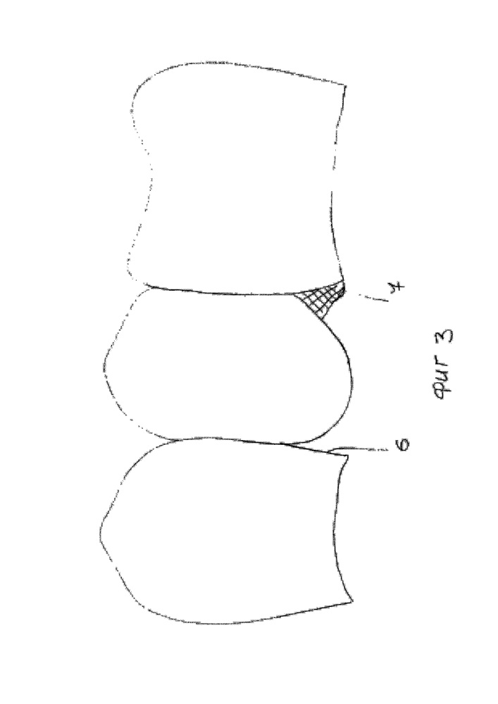 Контролируемый способ подготовки спаиваемых поверхностей несъемных зубных протезов (патент 2657191)