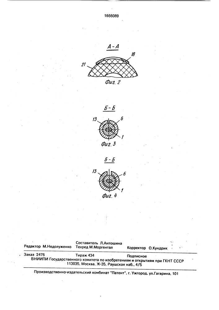 Устройство для остеосинтеза (патент 1666089)