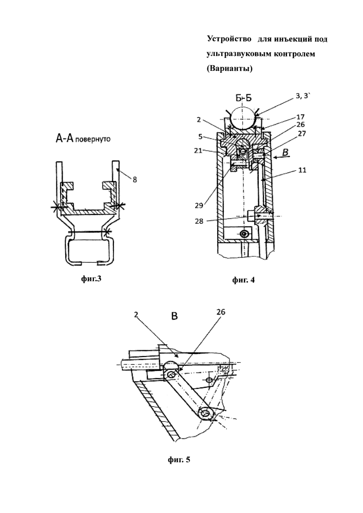 Устройство для инъекций под ультразвуковым контролем (варианты) (патент 2612262)