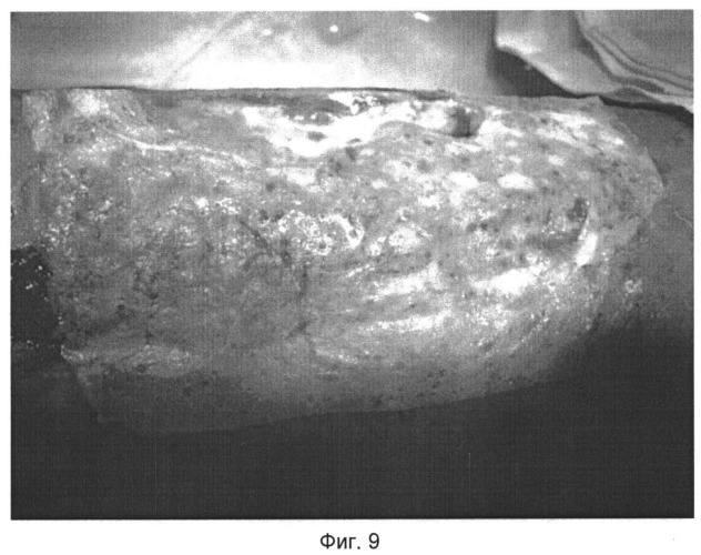 Технология регенеративной биопластики дефектов покровных тканей (патент 2547386)