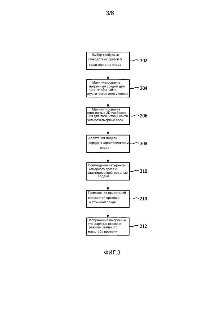 Автоматическое позиционирование стандартных плоскостей для оценки сердца плода в режиме реального времени (патент 2654611)