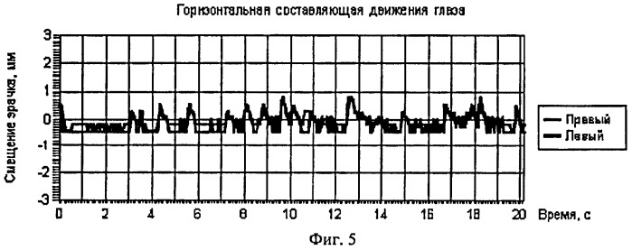 Способ подавления нистагма при движении глаз в различных направлениях (патент 2405406)