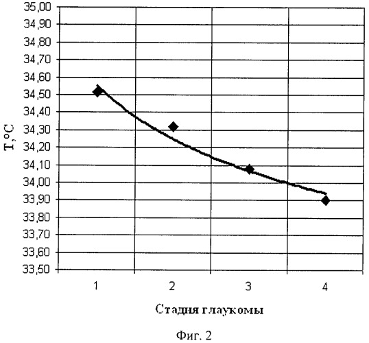 Способ оценки прогрессирования стадии первичной открытоугольной глаукомы (патент 2471405)