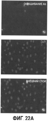 Вакцины на основе свиного вируса torque teno и способы диагностики инфекций, вызванных этим вирусом (патент 2553223)