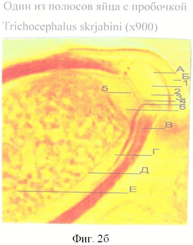 Способ прижизненной дифференциальной диагностики трихоцефал тrichocephalus ovis, trichocephalus skrjabini и trichocephalus capreoli жвачных животных (патент 2396069)