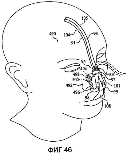 Назальный и оральный интерфейс пациента (патент 2447871)