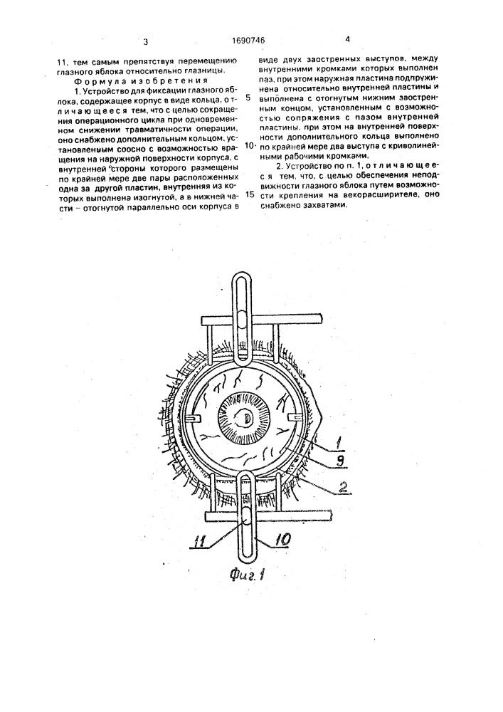 Устройство для фиксации глазного яблока (патент 1690746)