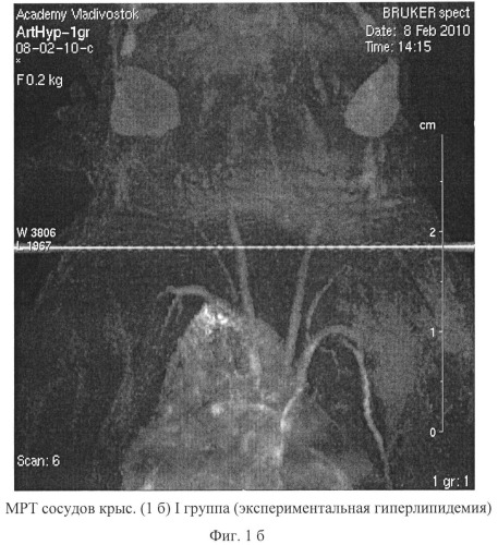 Способ моделирования атеросклероза (патент 2500041)