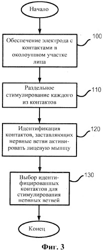 Система и способ стимуляции лицевого нерва (патент 2511082)