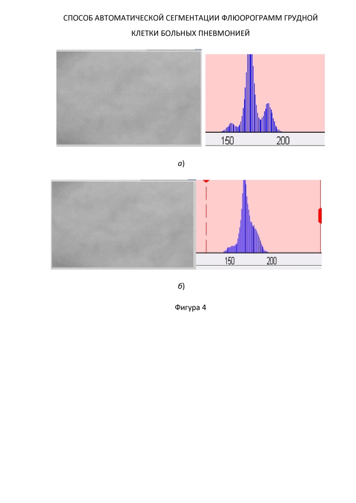 Способ автоматической сегментации флюорограмм грудной клетки больных пневмонией (патент 2629629)