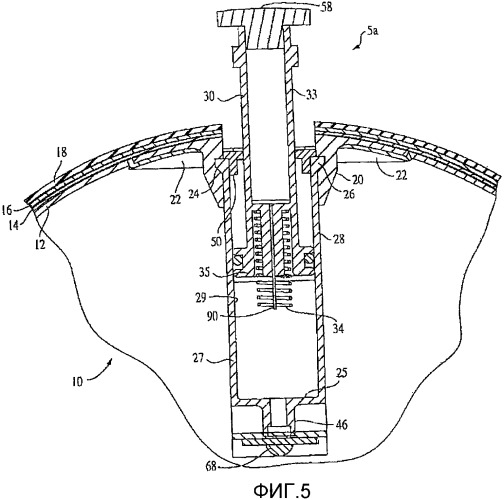 Спортивный мяч со встроенным надувочным механизмом, обладающим возможностями сброса и индикации давления (патент 2329081)