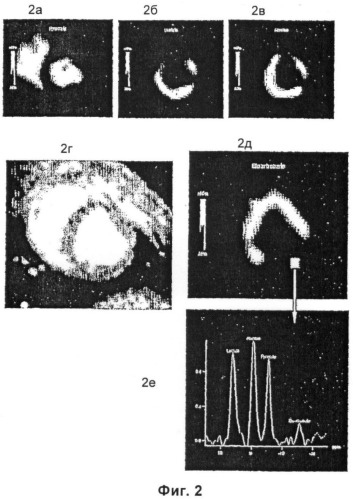 Способ визуализации сердца с использованием гиперполяризованного 13c-пирувата (патент 2391047)